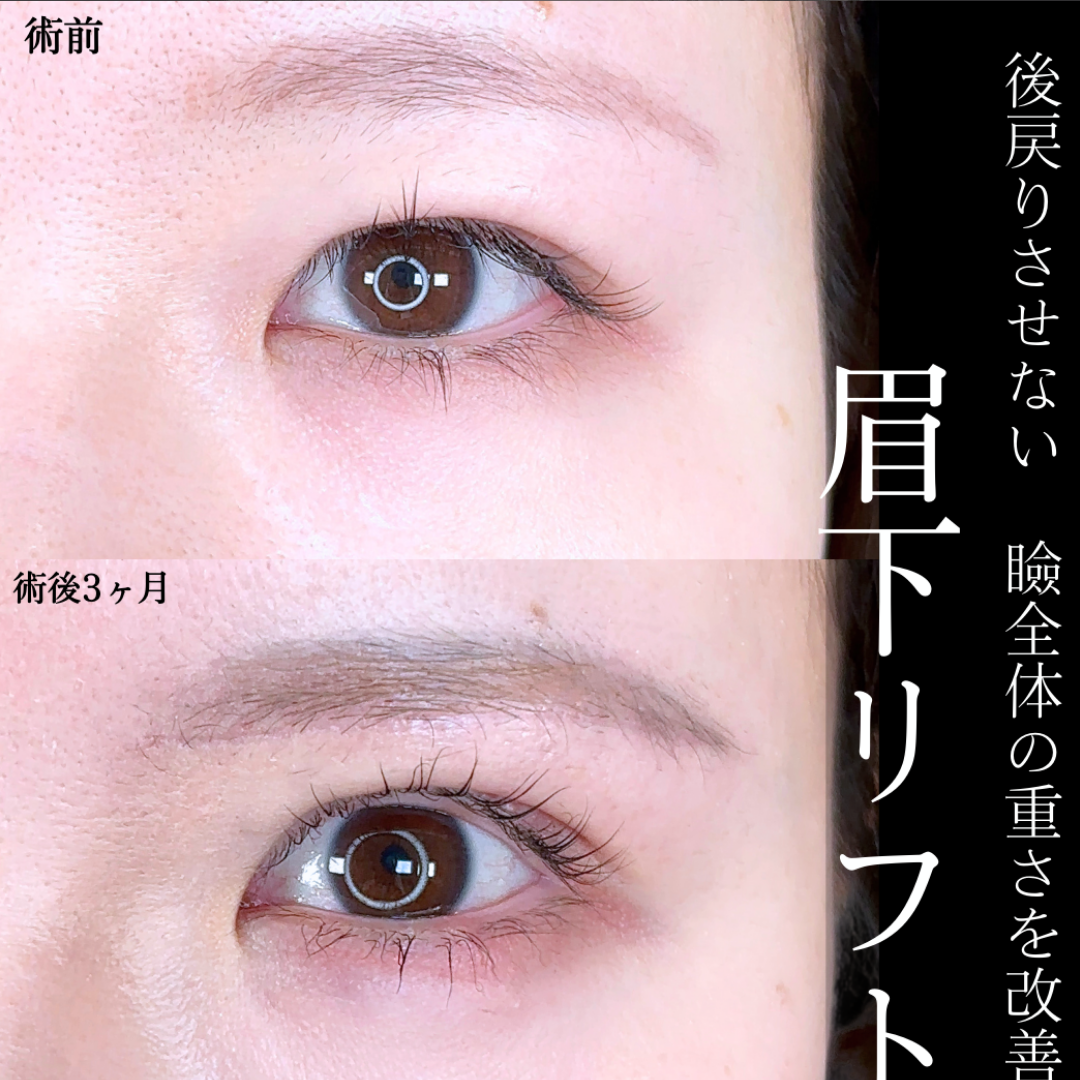 No.15769の症例写真
